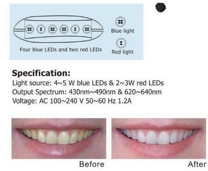 歯面漂白用加熱装置・歯科用ホワイトニング装置MD669