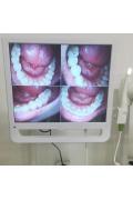 歯科口腔内カメラ1600万画素 （17インチ）（取り付け可能な柱）